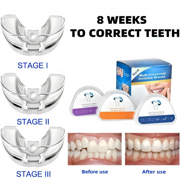 Orthodontic Braces Dental Braces Smile Teeth Alignment Trainer Instanted Silicone Teeth Retainer Mouth Guard Braces Tooth Tray